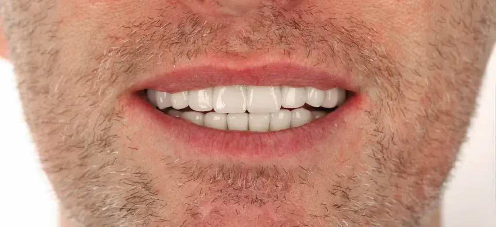 Zirconia Crown Before and After - Inci Dis Dental Clinic Turkey