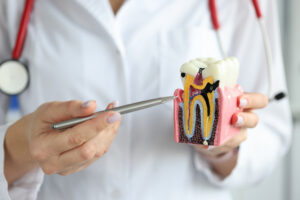 Root Canal Turkey - Inci Dis Dental Clinic Turkey