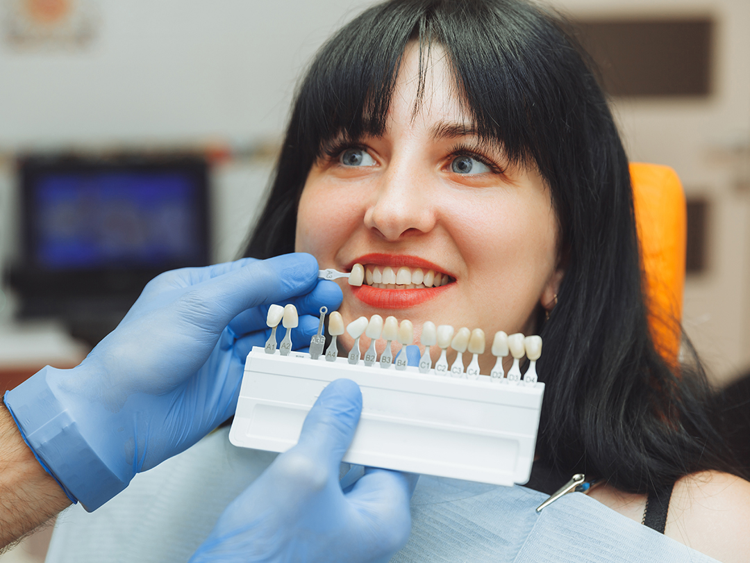 Teeth Veneers Cost Turkey