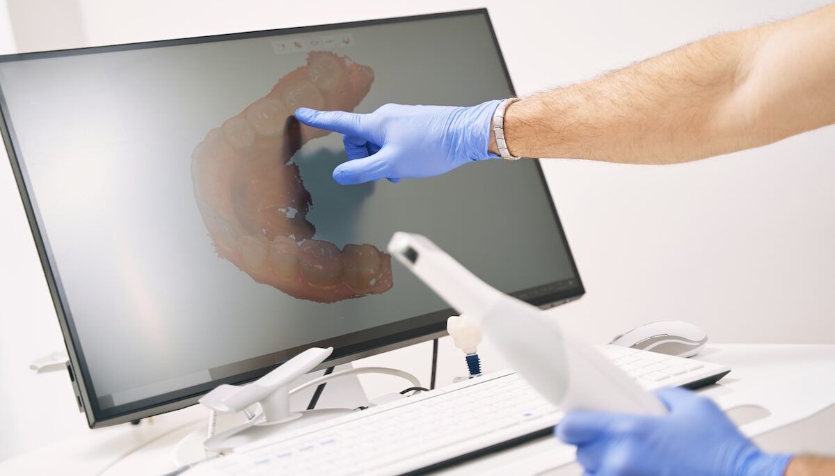 Dental Implants in Istanbul, Turkey – Doctor-Led Treatment for International Patients