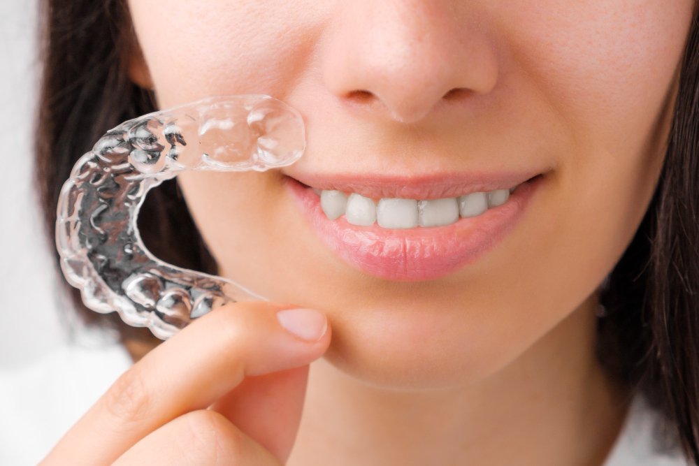 Invisalign Clear Aligners