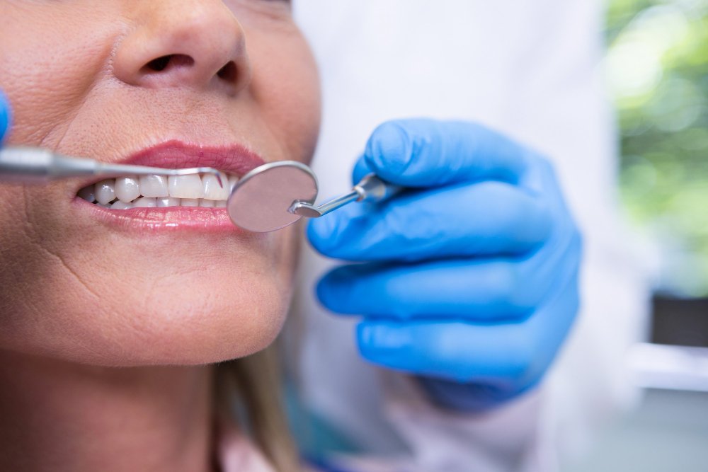 Gingivectomy | Crown Lengthening
